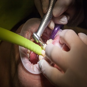general dentistry south yarra
